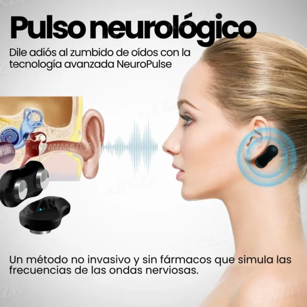 Audinix™ Tinnitus Dispositivo de Alivio