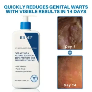 BBOJI® HPV Genital Warts Eraser Cream Ultra
