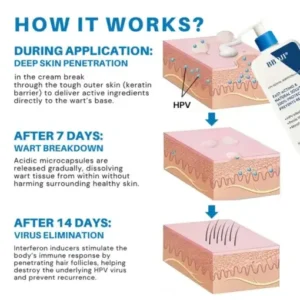BBOJI® HPV Genital Warts Eraser Cream Ultra