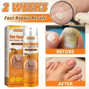 Cvreoz® Bee Venom Nail Repair Spray