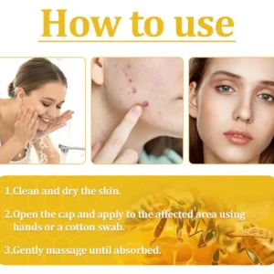 🔥FDA Approved⭐ WHO Approved🌍 Cvreoz® Bee Venom Skin Treatment Cream - Fast and effective⚡ targeting all skin issues✅ If ineffective, a refund is guaranteed💯