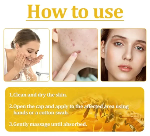 🔥FDA Approved⭐ WHO Approved🌍 Cvreoz® Bee Venom Skin Treatment Cream - Fast and effective⚡ targeting all skin issues✅ If ineffective, a refund is guaranteed💯