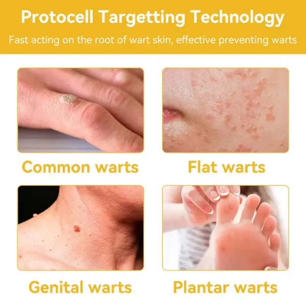 🔥FDA Approved⭐ WHO Approved🌍 Cvreoz® Bee Venom Skin Treatment Cream - Fast and effective⚡ targeting all skin issues✅ If ineffective, a refund is guaranteed💯