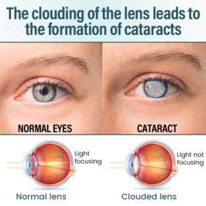 Alternative view of LAOZIK™ OptiFusion Nano Eye Drops Serum