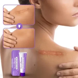 Timilk® RevivaDerma Face & Body Scar Gel