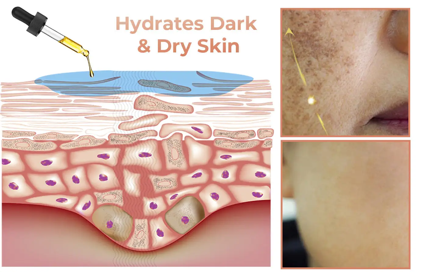 2025s,NESLEMY™ Fast Dark Spot Remover ✨ Where science meets luxury. Our melanin-correcting serum erase