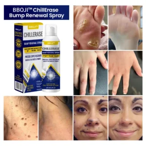 ✨BBOJI™ ChillErase Bump Renewal Spray