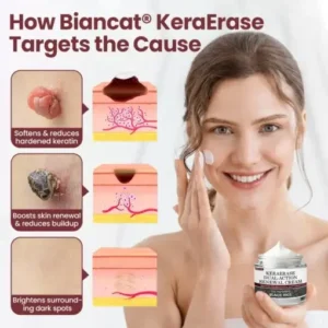 BBOJI®KeraErase Dual-Action Renewal Cream