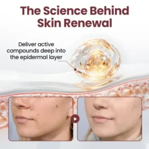 BBOJI®KeraErase Dual-Action Renewal Cream