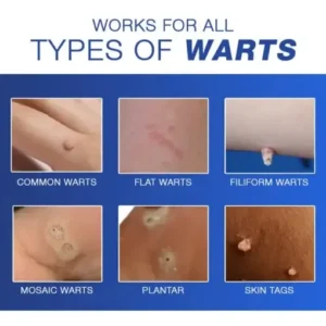 Cvreoz® Wart Eraser Pro