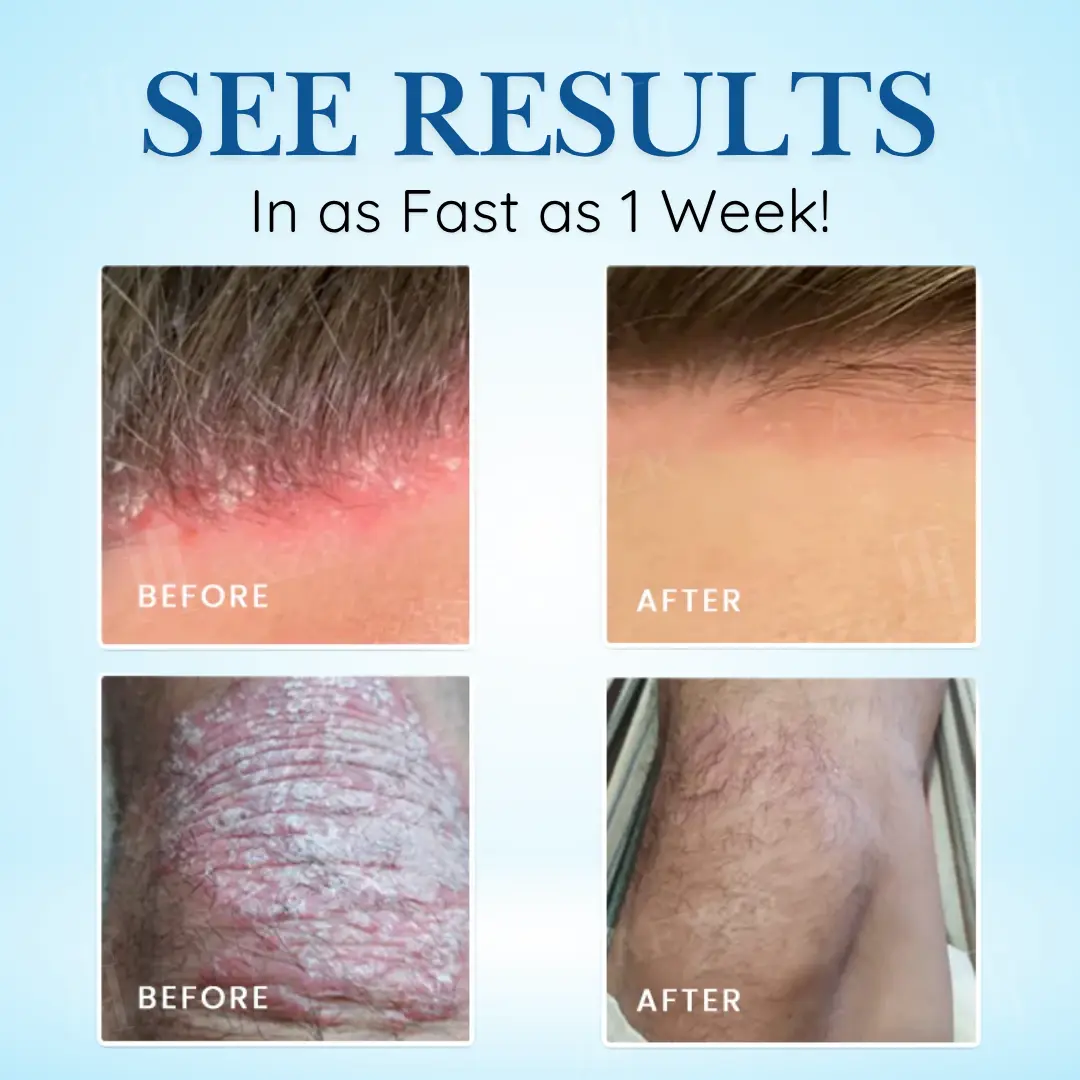 ✨Limited-Time 50% OFF Deal | Get Calm & Comfort for Less | Cvreoz® Source-Relief Magnesium Spray