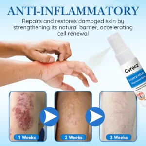 ✨Limited-Time 50% OFF Deal | Get Calm & Comfort for Less | Cvreoz® Source-Relief Magnesium Spray