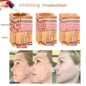 NESLEMY™ Fast Dark Spot Remover