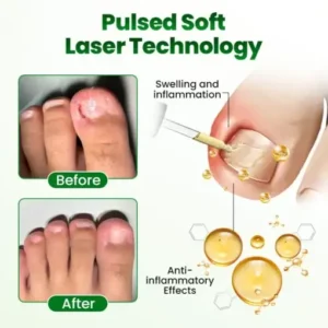 Timilk® HerbaNail 7-Day Repair Serum