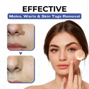 Timilk® VanishPro Skin Spot Removal Cream 🇬🇧 XH-VanishPro-upsell