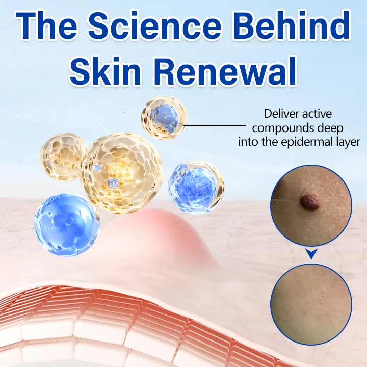 Timilk® WartClear Herbal Ointment 🇬🇧 XH-WartClear-UPSELL