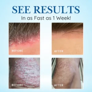 🏷️ EXCLUSIVE DEAL! 64% OFF - Cvreoz® Source-Relief Magnesium Spray (Copy)