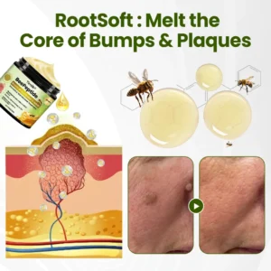 Timilk® BeePeptide RootSoft DualRelief Cream